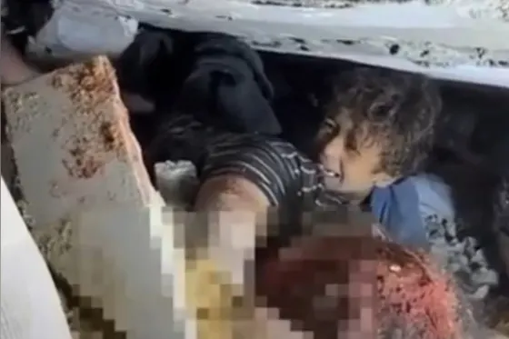 Immonde le silence des médias sur ce massacre israélien à retardement !