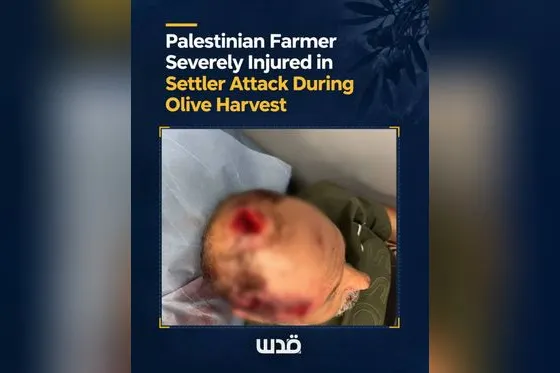 Ce que subissent les agriculteurs palestiniens qui veulent récolter leurs olives (Vidéos)