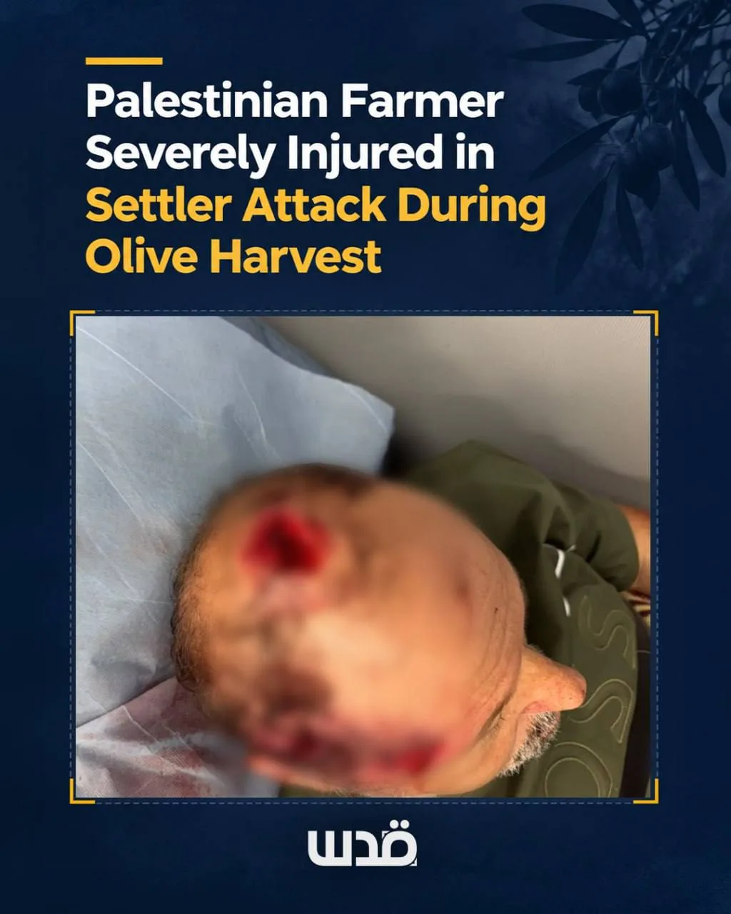 Ce que subissent les agriculteurs palestiniens qui veulent récolter leurs olives (Vidéos)