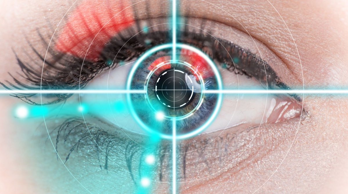 Eye